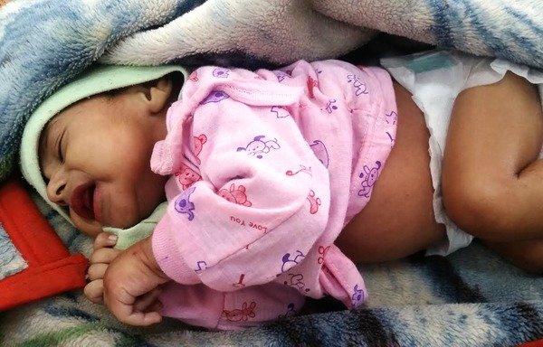 یک نوزاد دختر مبتلا به وبا در یک پتو در بیمارستان السابعین در صنعا خوابیده است. [عکس با کسب اجازه از عبدالطیف عبدالله]