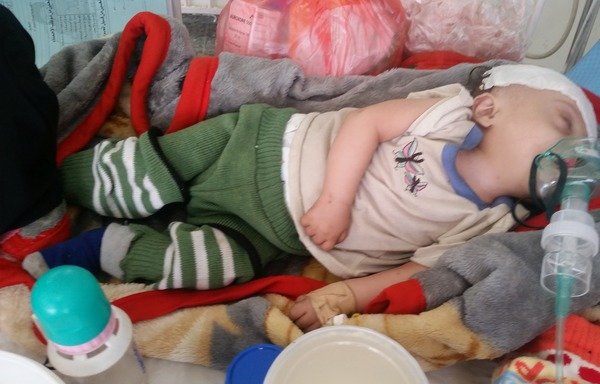 Un jeune Yéménite suspecté d'être atteint du choléra reçoit un traitement à la maternité de Sabeen à Sanaa. [Faisal Darem/Al-Mashareq]