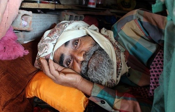 Le 16 janvier, un Yéménite déplacé, qui a fui les combats entre la coalition et les Houthis dans la région de Harad, se repose à l'ombre dans un camp pour déplacés internes dans le quartier d'Abs dans le nord de la province yéménite de Hajjah. [Stringer/AFP]
