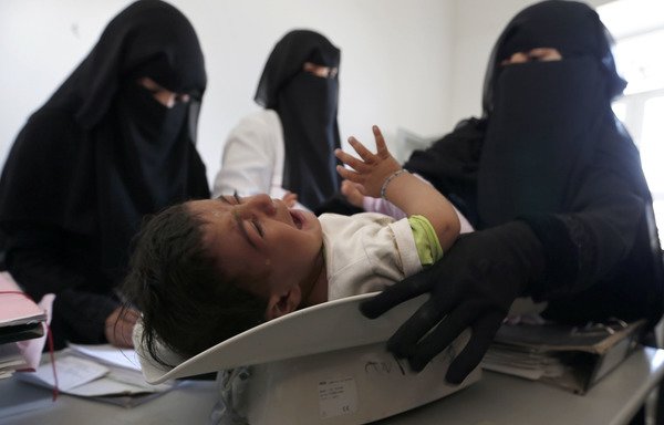 Une infirmière yéménite pèse un enfant dans un centre médical à la périphérie de Sanaa, le 6 janvier. [Mohammed Huwais / AFP]