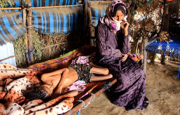 A Yemeni woman sits by the bedside of 10-year-old girl Ahmadia Abdo, who weighs only 10kg because of acute malnutrition, at a camp for the internally displaced in Hajjah province on January 23. [Essa Ahmed/AFP]